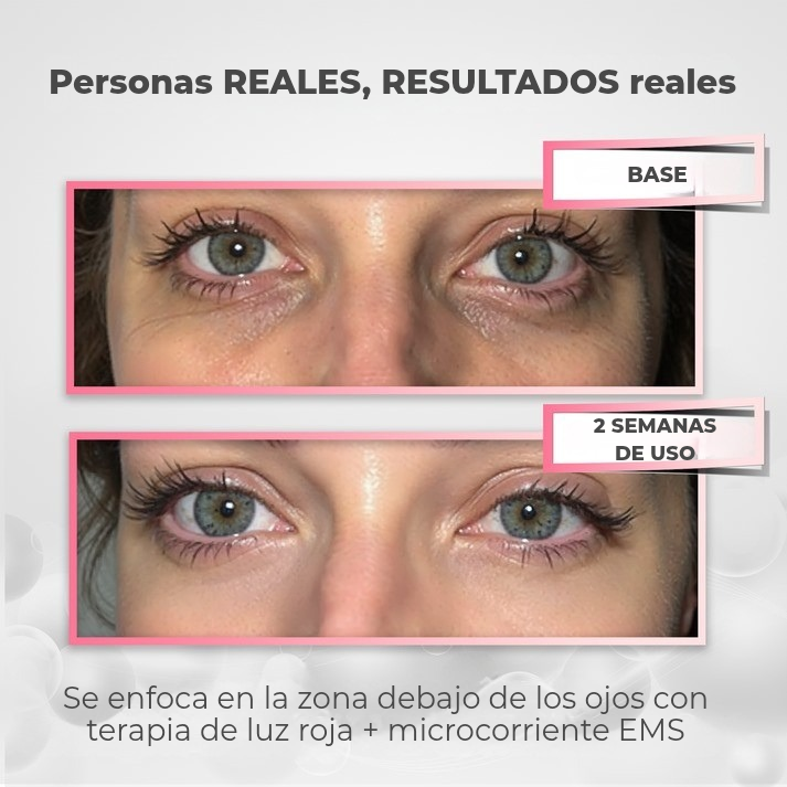 BrightAura™ | Gafas Elimina Ojeras 😍